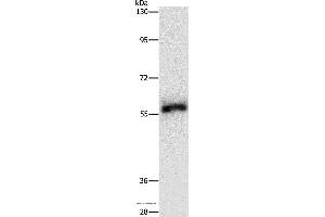 Western blot analysis of Hela cell, using HCK Polyclonal Antibody at dilution of 1:500 (HCK Antikörper)