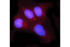 IF analysis of c-Rel/REL using anti-c-Rel/REL antibody (ABIN7599778). (c-Rel Antikörper  (AA 116-610))