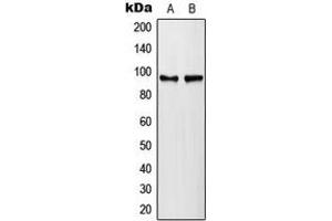 Western blot analysis of PLA2G4A (pS505) expression in HeLa lambda protein phosphatase-treated (A), NIH3T3 lambda protein phosphatase-treated (B) whole cell lysates. (PLA2G4A Antikörper  (pSer505))