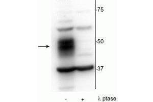 Western blot of OCIAML2 lysate showing specific immunolabeling of the ~51 kDa MEF2C phosphorylated at Ser222 in the first lane (-). (MEF2C Antikörper  (pSer222))