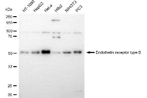 Western blotting analysis using endothelin receptor type B antibody (ABIN7798444).