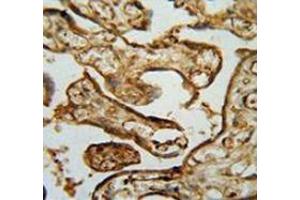 Immunohistochemistry analysis in human placenta tissue (Formalin-fixed, Paraffin-embedded) using MPP1 Antibody , followed by peroxidase conjugated secondary antibody and DAB staining. (MPP1 Antikörper  (Middle Region))