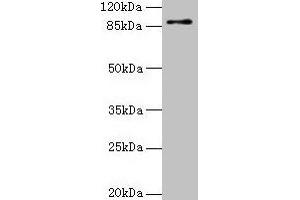 Western blot All lanes: RNF10 antibody at 4 μg/mL + Mouse brain tissue Secondary Goat polyclonal to rabbit IgG at 1/10000 dilution Predicted band size: 90, 91 kDa Observed band size: 90 kDa (RING1 Antikörper  (AA 401-630))