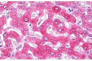 Anti-CRP antibody IHC staining of human liver. (CRP Antikörper)