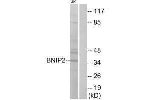 Western blot analysis of extracts from Jurkat cells, using BNIP2 antibody. (BNIP2 Antikörper  (C-Term))