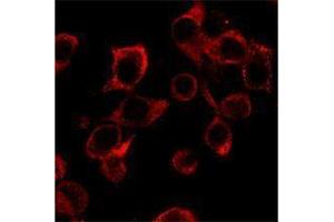 Immunofluorescence (IF) image for anti-Interleukin 23 (IL23) antibody (ABIN2665147) (IL23 Antikörper)