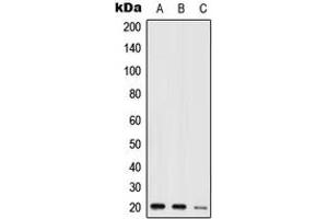 Western blot analysis of NIP7 expression in HEK293T (A), mouse kidney (B), H9C2 (C) whole cell lysates. (NIP7 Antikörper  (C-Term))