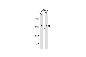 DHX9 Antibody (N-term) (ABIN1881260 and ABIN2843377) western blot analysis in K562 and 293 cell line lysates (35 μg/lane). (DHX9 Antikörper  (N-Term))