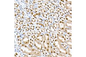 Immunohistochemistry of paraffin-embedded mouse kidney using RBM3 Rabbit mAb (ABIN7270084) at dilution of 1:25 (40x lens). (RBM3 Antikörper)