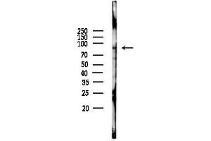 anti-NADPH Oxidase 5 (NOX5) (C-Term) antibody