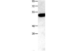 Western Blot analysis of Mouse kidney tissue using TNFRSF11B Polyclonal Antibody at dilution of 1:400 (Osteoprotegerin Antikörper)