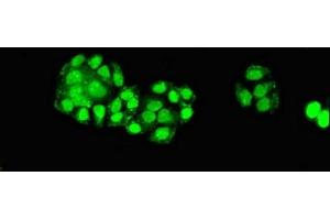 Immunofluorescent analysis of PC-3 cells using ABIN7151588 at dilution of 1:100 and Alexa Fluor 488-congugated AffiniPure Goat Anti-Rabbit IgG(H+L) (ELP6 Antikörper  (AA 95-195))