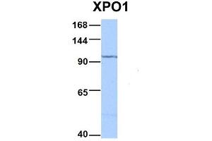 Host:  Rabbit  Target Name:  XPO1  Sample Type:  HepG2  Antibody Dilution:  1. (XPO1 Antikörper  (C-Term))