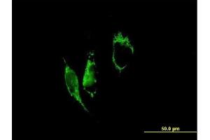 Immunofluorescence of purified MaxPab antibody to PYCR1 on HeLa cell. (PYCR1 Antikörper  (AA 1-319))