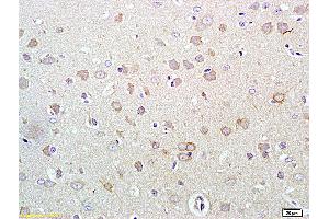 Formalin-fixed and paraffin embedded rat brain labeled with Rabbit Anti Phospho-HER3 (Tyr1289) Polyclonal Antibody, Unconjugated (ABIN747113) at 1:200 followed by conjugation to the secondary antibody and DAB staining (ERBB3 Antikörper  (pTyr1289))