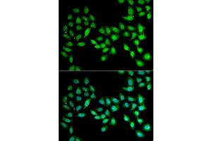 Immunofluorescence analysis of U2OS cell using UCN2 antibody. (Urocortin 2 Antikörper)