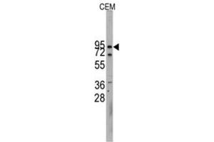 Image no. 1 for anti-Cadherin 10, Type 2 (T2-Cadherin) (CDH10) (N-Term) antibody (ABIN357004) (CDH10 Antikörper  (N-Term))