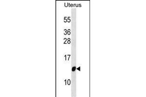 TI Antibody (Center) (ABIN6244225 and ABIN6577376) western blot analysis in Uterus tissue lysates (35 μg/lane). (TIMM10 Antikörper  (AA 21-49))