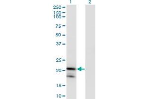 Western Blotting (WB) image for anti-Interleukin 1 Receptor Antagonist (IL1RN) (AA 1-159) antibody (ABIN517006)