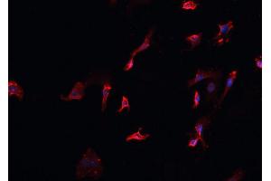 ABIN6266700 staining HeLa cells by IF/ICC. (MID1 Antikörper  (N-Term))