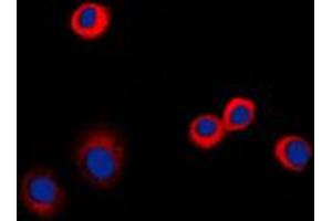 Immunofluorescent analysis of CD120b staining in PC12 cells. (TNFRSF1B Antikörper  (C-Term))