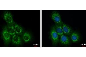 ICC/IF Image OCRL antibody detects OCRL protein at cytoplasm by immunofluorescent analysis. (OCRL Antikörper  (C-Term))