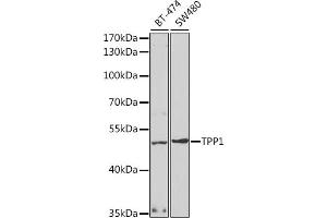 Western blot analysis of extracts of various cell lines, using TPP1 antibody (ABIN6127693, ABIN6149442, ABIN6149443 and ABIN6221263) at 1:1000 dilution. (TPP1 Antikörper  (AA 284-563))
