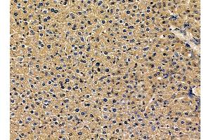 ABIN7095380 and ABIN7099437 at 1/100 staining mouse liver tissue by IHC-P.