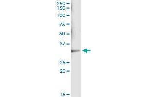 Immunoprecipitation (IP) image for anti-Sulfotransferase Family, Cytosolic, 1A, Phenol-Preferring, Member 1 (SULT1A1) (AA 1-295) antibody (ABIN520604)
