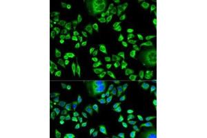 Immunofluorescence analysis of HeLa cells using CSTA Polyclonal Antibody (CSTA Antikörper)