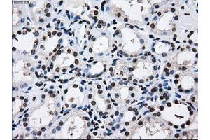 Image no. 7 for anti-Replication Protein A2, 32kDa (RPA2) antibody (ABIN1500736)