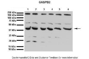 Lanes:   1. (GABPB2 Antikörper  (C-Term))