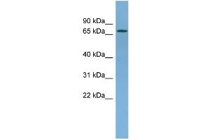 WB Suggested Anti-NDUFS1 Antibody Titration: 0. (NDUFS1 Antikörper  (Middle Region))