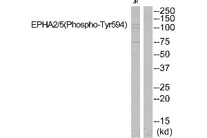 Western blot analysis of extracts from JK cells, using EPHA2/5 (Phospho-Tyr594) Antibody. (EPHA2/5 (pTyr594) Antikörper)