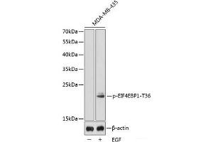Western blot analysis of extracts from MDA-MB-435 cells using Phospho-EIF4EBP1(T36) Polyclonal Antibody. (eIF4EBP1 Antikörper  (pThr36))