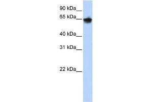 WB Suggested Anti-KRT1 Antibody  Titration: 1 ug/ml Positive Control: 293T cells lysate (Cytokeratin 1 Antikörper  (Middle Region))