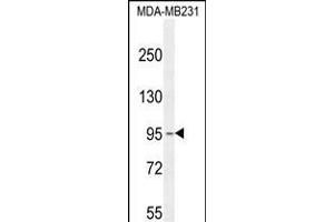 KCNT2 Antibody (C-term) (ABIN654309 and ABIN2844095) western blot analysis in MDA-M cell line lysates (35 μg/lane). (KCNT2 Antikörper  (C-Term))