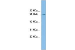 WB Suggested Anti-SLC6A1 Antibody Titration: 0. (SLC6A1 Antikörper  (Middle Region))