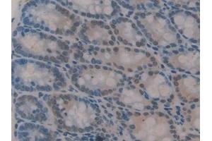 Detection of GLI3 in Mouse Colon Tissue using Polyclonal Antibody to GLI Family Zinc Finger Protein 3 (GLI3) (GLI Family Zinc Finger Protein 3 (AA 303-561) Antikörper)
