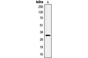 Western blot analysis of Kallikrein 3 expression in LNCaP (A) whole cell lysates. (Prostate Specific Antigen Antikörper  (Center))