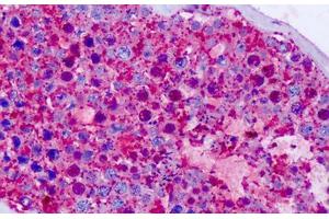 Anti-CELSR1 antibody IHC staining of human testis.