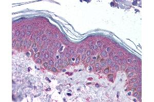 Immunohistochemistry (IHC) image for anti-serpin Peptidase Inhibitor, Clade F (Alpha-2 Antiplasmin, Pigment Epithelium Derived Factor), Member 1 (SERPINF1) (N-Term) antibody (ABIN6739671)