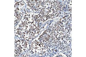 IHC analysis of SF3A1 using anti-SF3A1 antibody (ABIN7600556). (SF3A1 Antikörper  (AA 20-556))