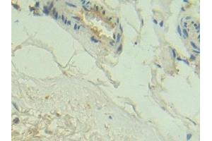 Immunohistochemistry (IHC) image for anti-Complement C2 (AA 245-451) antibody (ABIN7432784)