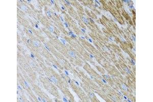 Immunohistochemistry of paraffin-embedded Mouse heart using MTX2 Polyclonal Antibody at dilution of 1:100 (40x lens). (MTX2 Antikörper)