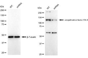 Western blotting analysis using ubiquitination factor E4 A antibody (ABIN7800764).