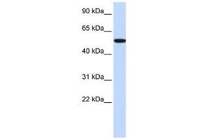 RIPK2 antibody (70R-10459) used at 0. (RIPK2 Antikörper  (Middle Region))