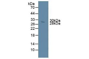 Detection of NME6 in Rat Spleen Tissue using Polyclonal Antibody to Non Metastatic Cells 6, Protein Expressed In (NME6) (NME6 Antikörper  (AA 1-173))