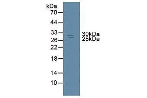 Detection of NME6 in Rat Spleen Tissue using Polyclonal Antibody to Non Metastatic Cells 6, Protein Expressed In (NME6) (Non Metastatic Cells 6, Protein Expressed In (AA 1-173) Antikörper)