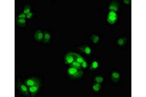 Immunofluorescent analysis of MCF-7 cells using ABIN7164202 at dilution of 1:100 and Alexa Fluor 488-congugated AffiniPure Goat Anti-Rabbit IgG(H+L) (TSR2 Antikörper  (AA 1-191))